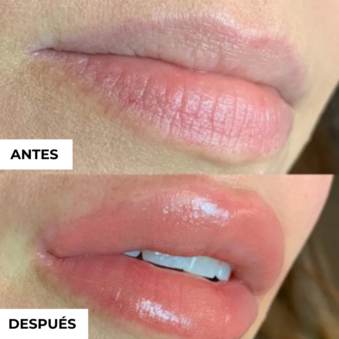 Voluminizador de Labios