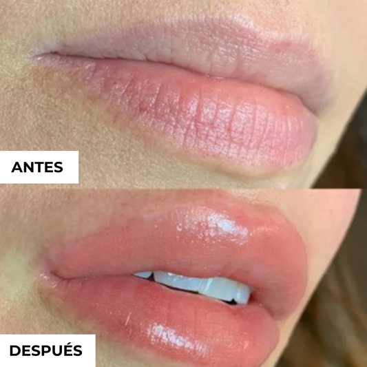 Voluminizador de Labios